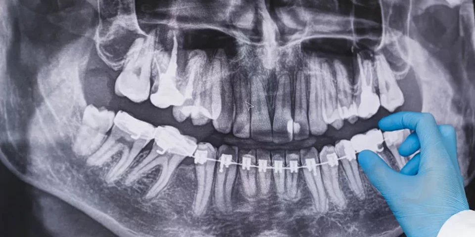 Radiographie et Imagerie